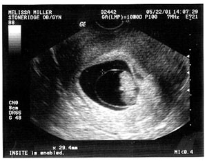 our first ultrasound